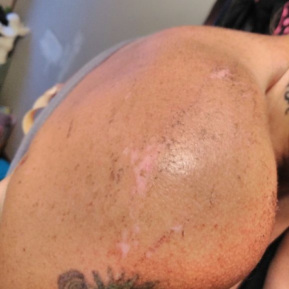 Update on Me!!🙏🛐 - Picture 5 of 7